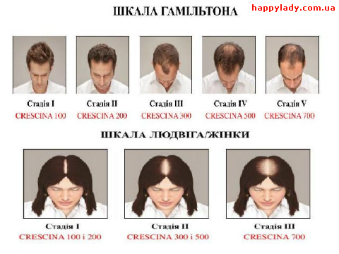 Как лечить волосы от гнид